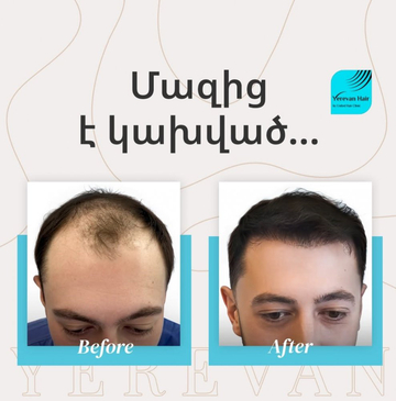 Slider image (6) United Hair Clinic